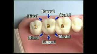 V109 Patient Records Management amp Dental Charting [upl. by Auqenwahs756]