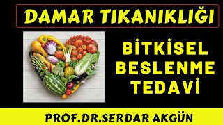 Damar Tıkanıklığı Bitkisel Tedavi ile Açılır mı Bitkiler Damar Tıkanıklığı Tedavisi [upl. by Nasas699]