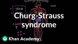 ChurgStrauss syndrome  Circulatory System and Disease  NCLEXRN  Khan Academy [upl. by Acebber]