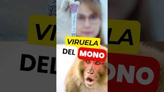 ¿EXISTE algún Tratamiento Eficaz para la VIRUELA del MONO 🙊 💉 virueladelmono mpox [upl. by Zilevi421]