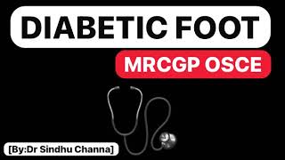 12DIABETIC FOOTMRCGP OSCE [upl. by Wilden980]