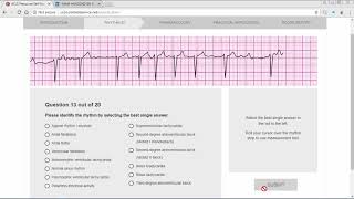 ACLS Precourse ECG Rhythm [upl. by Aicatsan]