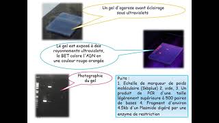 TECHNIQUES DE SÉPARATION ET D’ANALYSE DES ACIDES NUCLÉIQUES  ADN ARN amp PLASMIDES 2 [upl. by Gnahc309]