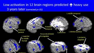 This is Your Brain on Drugs [upl. by Hteik170]