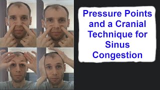 Pressure Points and a Cranial Technique for Sinus Congestion [upl. by Neryt]