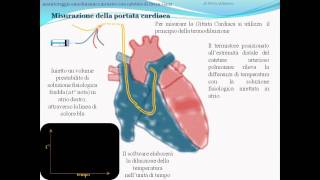 monitoraggio emodinamico invasivo e catetere di Swan Ganz parte 1avi [upl. by Benildis]