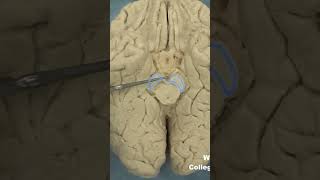 Interpeduncular fossa neuroanatomy brainstembrainWCUCOM Neuroscience [upl. by Telrats373]