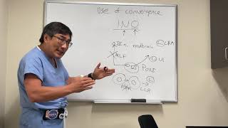 Testing convergence to localise internuclear ophthalmoplegia INO lesion [upl. by Alan]