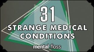 31 Strange Medical Conditions  Summer Bummer Series pt 1  mentalfloss on YouTube Ep13 [upl. by Henarat]