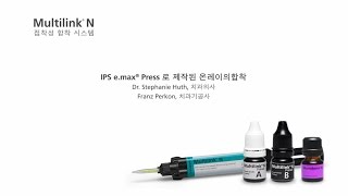 Multilink N  IPS emax Press로 제작된 온레이의 합착 [upl. by Kcinimod]