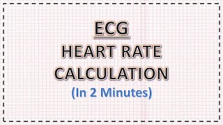 ECG Heart Rate Calculation  In 2 minutes  ECG Interpretation [upl. by Aidua364]