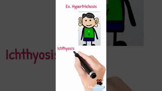 Holandric genes  Ylinked genes  Hypertrichosis  Ichthyosis [upl. by Lizned]