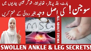 Foot And Ankle Swelling What Causes It  Edema Causes amp Treatment Listen Your Body [upl. by Sibyl]