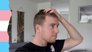 Facing Hair Loss  vlog 108 [upl. by Karine312]