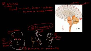 Migraine pathophysiology [upl. by Sire46]