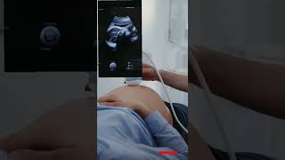 sonography Ultrasonography ultrasound test pregnancy baby [upl. by Homer]