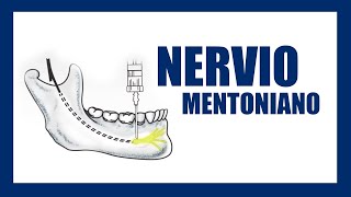 Técnica de anestesia Nervio mentoniano [upl. by Holladay]