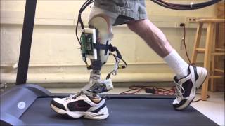 UMass MRRL Active Alignment Prosthesis [upl. by Littlejohn]