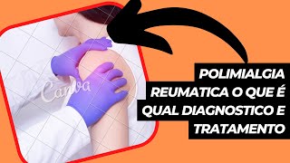 polimialgia reumatica o que é qual diagnostico e tratamento [upl. by Ecyned426]