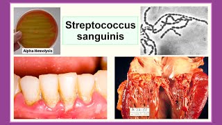 Streptococcus sanguinis [upl. by Leugar286]