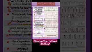 Normal vs Abnormal Heart Rhythms Quick ECG Guidequot musicart trendingshortsviralshortviralvideo [upl. by Bobbe]