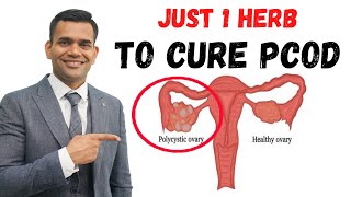 Just 1 Teaspoon Per Day To Cure PCODPCOS amp Irregular Periods Permanently [upl. by Bronny]