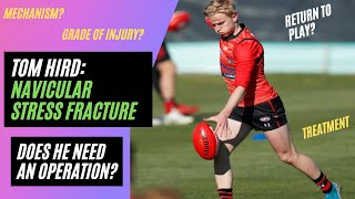 Navicular Stress Fracture Essendon Bombers Tom Hird  Injury Analysis [upl. by Hardie130]