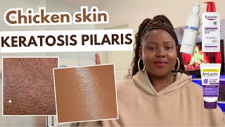 Keratosis Pilaris How to Treat Rough Bumpy Skin Chicken Skin Esthetician Tips [upl. by Verger]