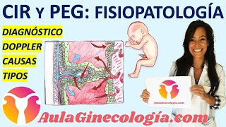 CIR y PEG FISIOPATOLOGÍA 🚼 CRECIMIENTO INTRAURTERINO👶🏼 RESTRINGIDO  Ginecología y Obstetricia [upl. by Duvall783]