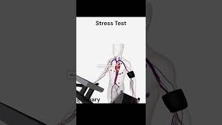 Stress Test [upl. by Feodora]