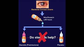 SCUT  Steroids for Corneal Ulcers Trial [upl. by Trilbie]