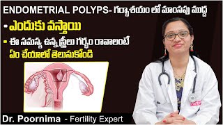 గర్భాశయ పాలిప్స్  How To Deal With Endometrial Polyp For Pregnancy  Fertility Tips Telugu  Ferty9 [upl. by Kwang]