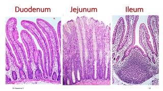 Histology of Duodenum Jejunum amp Ileum [upl. by Juno121]