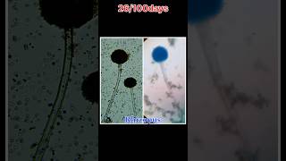 Rhizopus bacteria sudhanshuvlogs shorts minivlog dailyvlog [upl. by Sidwel114]