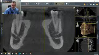 CBCT scan review by Dr Aneszko at WTDC Chicago [upl. by Shamus]