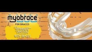 Myobrace for braces [upl. by Bently]