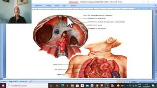 Paediatric Surgery in Arabic 1 Congenital Diaphragmatic Hernia  part 1   by Dr Wahdan [upl. by Aneloaup]