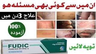 FUDIC FUDIC fusidic acid cream uses in UrduFUDIC CREAMhow to use FUDIC CREAM in Urdu [upl. by Eneleoj]