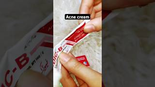 Best acne cream watch full vedio on youtube channel acnetreatmentshortsfeed shortsviralshorts [upl. by Sandon537]