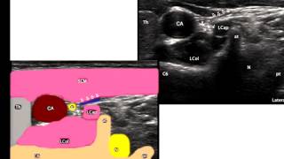 Pain Medicine  Cervical Sympathetic Trunk [upl. by Salakcin82]