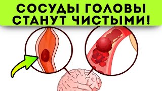 Смотрите что делают старые врачи для чистки сосудов головы Сосуды головы чистят [upl. by Celene818]