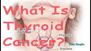 What is Thyroid Cancer [upl. by Antons951]