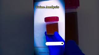 Urine Analysis Complete  Urine RE  bacteria microscope science 1millionviews viral shorts [upl. by Judenberg]