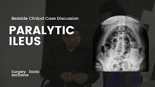 Paralytic Ileus  Presentation evaluation and management Clincalculable case discussion [upl. by Chally]