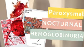 Paroxysmal Nocturnal Hemoglobinuria PNHDefinitionPathophysiologyTreatment [upl. by Hgielak590]