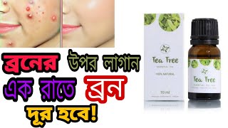 ব্রনের উপর লাগালে ব্রন চলে যাবে  টি ট্রি অয়েল tea tree oil  khadija begum [upl. by Ytteb]