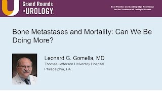 Bone Metastases and Mortality Can We Be Doing More [upl. by Farant]