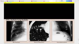 RADIOLOGY EXAM CASES [upl. by Ecnarf478]