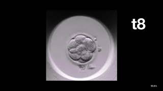 MIRI® TL  TimeLapse Annotation of an Embryo  Esco Medical [upl. by Suivatal104]