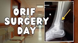 Surgery Day  WORST PAIN OF MY LIFE  Fractured Fibula Pt 2 [upl. by Magnuson]